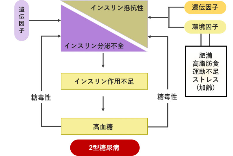 ２型糖尿病の原因